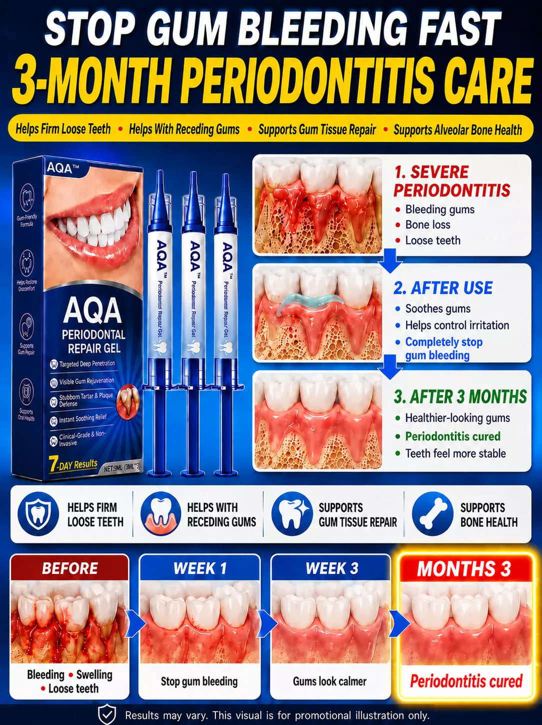Don’t Put Off Treating Loose Teeth Any Longer! Stop Bleeding Completely in 7 Days and Cure Periodontitis in 3 Months!