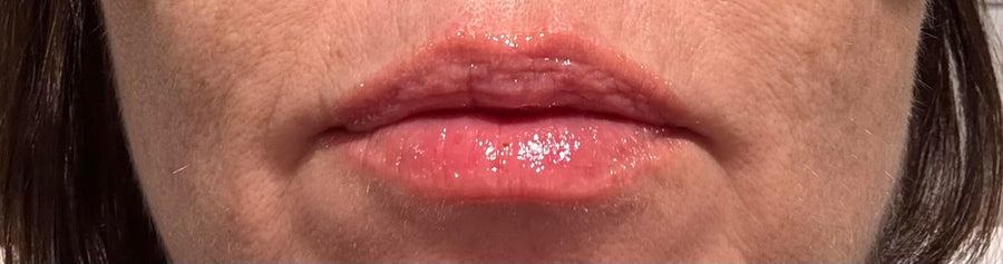 Customer using PDRN Peptide Glossy Lip Balm