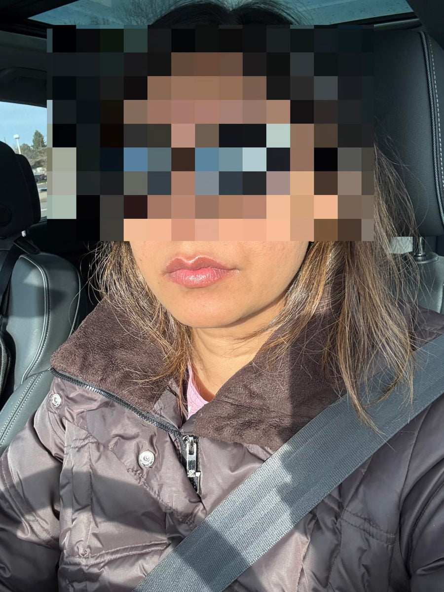 Customer using PDRN Peptide Glossy Lip Balm