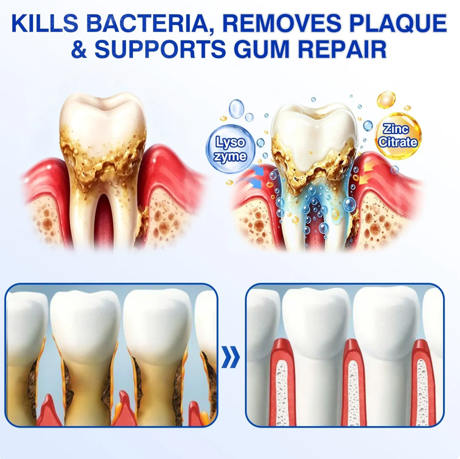 Step 1: Targeted Antimicrobial Action & Plaque Disruption